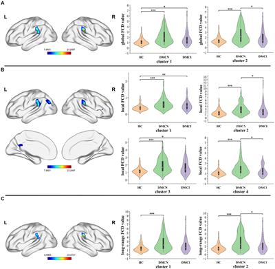 Functional connectivity density aberrance in type 2 diabetes mellitus with and without mild cognitive impairment